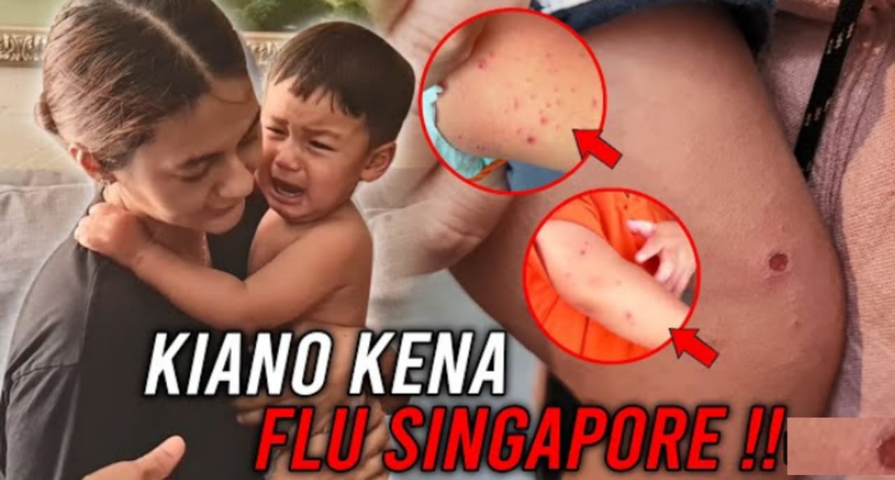 Kiano Toger Wong Positif Flu Singapura
