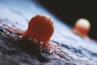 AI Akhirnya Memecahkan Misteri Kanker Berusia Seabad

