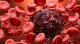 AI Blood Cell Analyzer Mengungguli Pakar Manusia dalam Mendeteksi Leukemia


