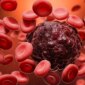 AI Blood Cell Analyzer Mengungguli Pakar Manusia dalam Mendeteksi Leukemia

