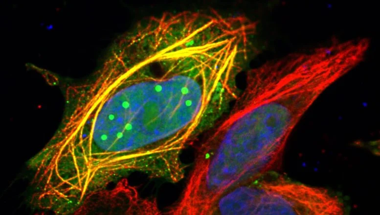 Ilmuwan Baru Saja Menemukan Bagaimana Rabies Membajak Sel Manusia

