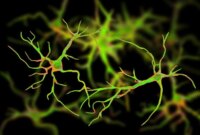 Ilmuwan Menemukan Cara untuk Membantu Otak Membersihkan Plak Alzheimer Secara Alami

