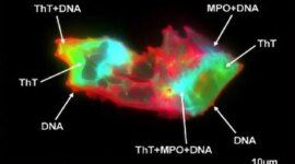 Ilmuwan Mengungkap Pola Darah Tersembunyi di Long COVID

