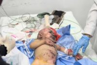 Israel Memberi Tahu AS Sebelum Serangan Gaza yang Menewaskan 28 Warga Sipil, Laporan Media Israel

