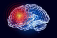 Kekurangan Nutrisi Umum Dapat Memicu Kerusakan Otak Dini pada Dewasa Muda

