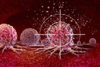 Mematikan Protein Ini Dapat Menghentikan Kanker Paru-Paru

