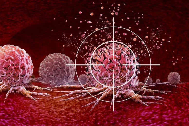 Mematikan Protein Ini Dapat Menghentikan Kanker Paru-Paru

