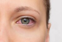 Membalikkan Hal yang Tidak Dapat Dibalikkan? Uji Coba Pertama pada Manusia Menunjukkan Sel Punca Dapat Memulihkan Kehilangan Penglihatan pada Pasien AMD

