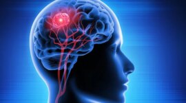 Nanodrop Hidung Baru Membasmi Tumor Otak pada Tikus

