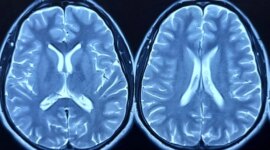 Rekaman Otak Dalam Mengungkap Bagaimana Moujaro Menekan Nafsu Makan

