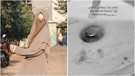 Sayangnya, Wardatina Mawa muntah darah setelah Insanul Fahmi diduga selingkuh dengan Inara Rusli

