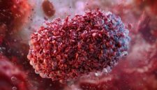 AI Baru Saja Mengungkap Kelemahan Tersembunyi Cacar Monyet pada Vaksin Baru