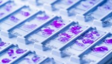 Apa yang Dipelajari AI dari Kanker Mengejutkan Para Peneliti