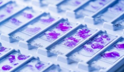 Slide Kaca Mikroskop Patologi Kanker