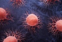 Ilmuwan Memecahkan Misteri Kanker Pankreas: Pendorong Utama Penyebaran Mematikan yang Luar Biasa Teridentifikasi

