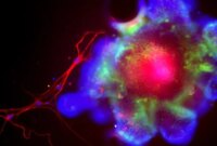 Ilmuwan Menemukan Protein yang Memungkinkan Alkohol Merusak Hati Anda

