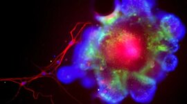 Ilmuwan Menemukan Protein yang Memungkinkan Alkohol Merusak Hati Anda

