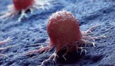 Nanodot Logam Kecil Menghilangkan Sel Kanker Sambil Menghemat Sebagian Besar Jaringan Sehat

