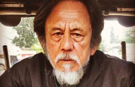 Penyebab meninggalnya Epy Kusnandar yang diungkap temannya adalah penyakit di otak

