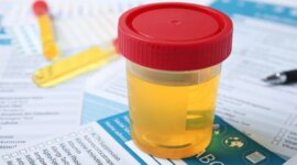 Tes Urin Sederhana Dapat Merevolusi Diagnosis dan Pengobatan Kanker Kandung Kemih

