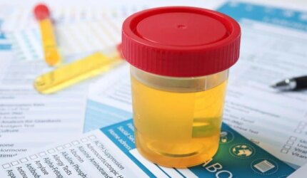 Uji Laboratorium Tabung Sampel Urin